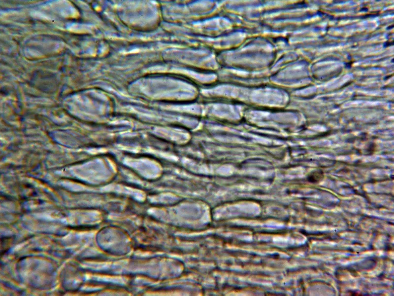 Calycellina albida 10 - Excípulo 2